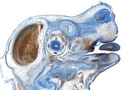 Invitrogen EphA3 Polyclonal Antibody 100 &mu;g | Buy Online | Invitrogen&trade; | Fisher Scientific