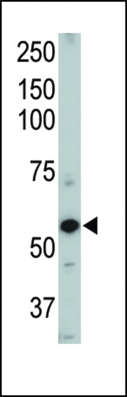 ACVRL1 Polyclonal Antibody 400 &mu;L | Buy Online | Invitrogen | Fisher Scientific