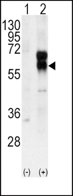 ACVRL1 Polyclonal Antibody 400 &mu;L | Buy Online | Invitrogen | Fisher Scientific