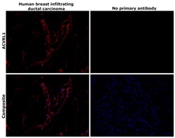 ACVRL1 Polyclonal Antibody:Antibodies, Polyclonal