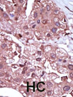 ACVRL1 Polyclonal Antibody:Antibodies, Polyclonal