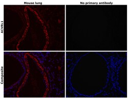 ACVRL1 Polyclonal Antibody:Antibodies, Polyclonal