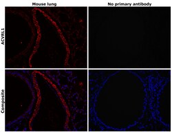 ACVRL1 Polyclonal Antibody:Antibodies, Polyclonal