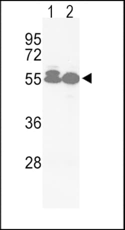ACVRL1 Polyclonal Antibody:Antibodies, Polyclonal