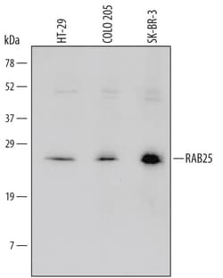 Invitrogen RAB25 Polyclonal Antibody 100 &mu;g; Unconjugated:Antibodies,
