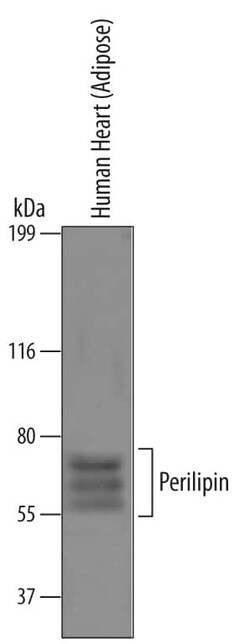 Invitrogen Perilipin 1 Polyclonal Antibody 100 &mu;g; Unconjugated:Antibodies,