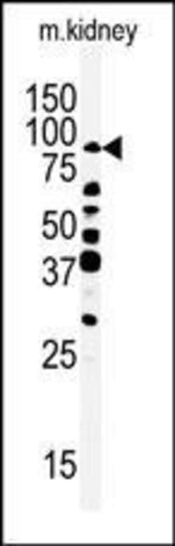 Invitrogen RIPK4 Polyclonal Antibody 400 &mu;L | Buy Online | Invitrogen&trade; | Fisher Scientific