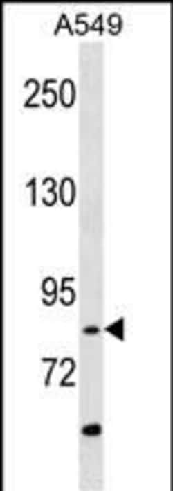 Invitrogen RIPK4 Polyclonal Antibody 400 &mu;L | Buy Online | Invitrogen&trade; | Fisher Scientific