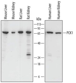 Invitrogen PCK1 Polyclonal Antibody 100 &mu;g; Unconjugated:Antikörper