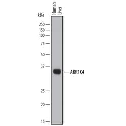 Invitrogen AKR1C4 Polyclonal Antibody 100 &mu;g; Unconjugated:Antibodies,