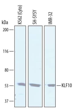 Invitrogen KLF10 Polyclonal Antibody 100 &mu;g; Unconjugated:Antikörper