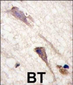 Invitrogen B-Raf Polyclonal Antibody 400 &mu;L; Unconjugated:Antibodies,