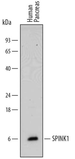 Invitrogen SPINK1 Polyclonal Antibody 100 &mu;g; Unconjugated:Antibodies,