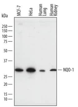 Invitrogen NQO1 Polyclonal Antibody 100 &mu;g; Unconjugated:Antikörper