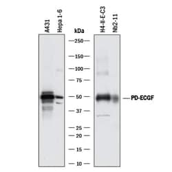 Invitrogen Thymidine Phosphorylase Polyclonal Antibody 100 &mu;g; Unconjugated:Antibodies,