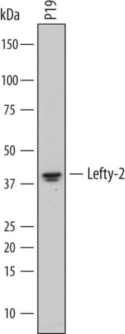 Invitrogen LEFTY2 Polyclonal Antibody 100 &mu;g; Unconjugated:Antibodies,