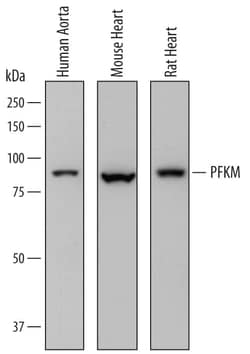 Invitrogen PFKM Polyclonal Antibody 100 &mu;g; Unconjugated:Antikörper