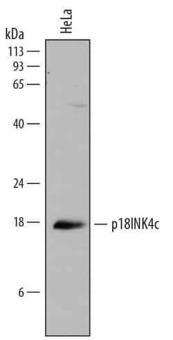 Invitrogen CDKN2C Polyclonal Antibody 100 &mu;g; Unconjugated:Antibodies,