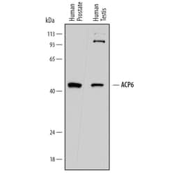 Invitrogen ACP6 Polyclonal Antibody 100 &mu;g; Unconjugated:Antibodies,