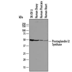 Invitrogen PTGIS Polyclonal Antibody 100 &mu;g; Unconjugated:Antibodies,