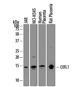 Invitrogen COTL1 Polyclonal Antibody 100 &mu;g; Unconjugated:Antibodies,