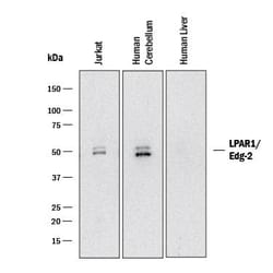 Invitrogen EDG2 Polyclonal Antibody 100 &mu;g | Buy Online | Invitrogen&trade; | Fisher Scientific