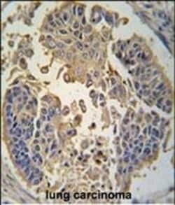 Invitrogen RIP3 Polyclonal Antibody 400 μL; Unconjugated:Antibodies,