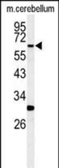 Invitrogen RIP3 Polyclonal Antibody 400 μL; Unconjugated:Antibodies,