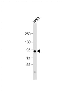Invitrogen TGM2 Polyclonal Antibody 400 &mu;L | Buy Online | Invitrogen&trade; | Fisher Scientific