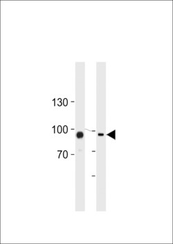 Invitrogen TGM2 Polyclonal Antibody 400 &mu;L | Buy Online | Invitrogen&trade; | Fisher Scientific