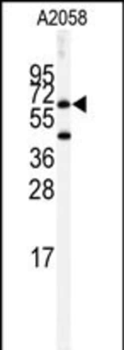 Invitrogen Butyrylcholinesterase Polyclonal Antibody 400 &mu;L; Unconjugated:Antibodies,