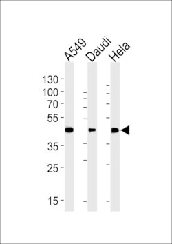 Invitrogen ALDH3A1 Polyclonal Antibody 400 &mu;L; Unconjugated:Antibodies,