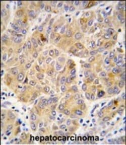 Invitrogen ALDH9A1 Polyclonal Antibody 400 &mu;L | Buy Online | Invitrogen&trade; | Fisher Scientific