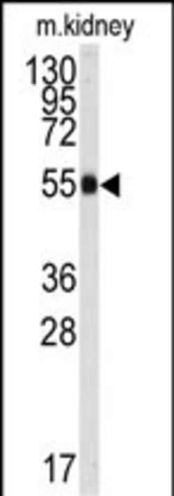 Invitrogen ALDH9A1 Polyclonal Antibody 400 &mu;L | Buy Online | Invitrogen&trade; | Fisher Scientific