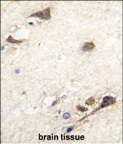 Invitrogen Acetylcholinesterase Polyclonal Antibody 400 &mu;L; Unconjugated:Antibodies,