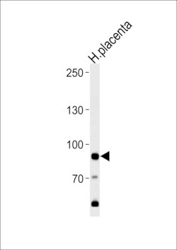 Invitrogen AMPD3 Polyclonal Antibody 400 &mu;L; Unconjugated:Antibodies,