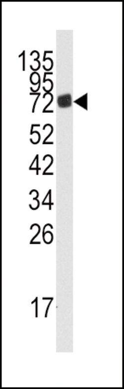 Invitrogen AMPD3 Polyclonal Antibody 400 &mu;L; Unconjugated:Antibodies,