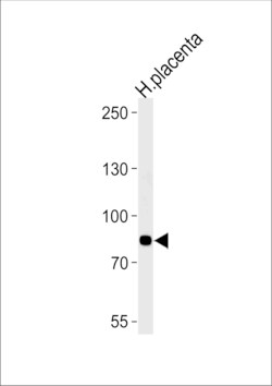 Invitrogen AMPD3 Polyclonal Antibody 400 &mu;L; Unconjugated:Antibodies,