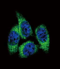 Invitrogen CYP17A1 Polyclonal Antibody 400 &mu;L; Unconjugated:Antibodies,