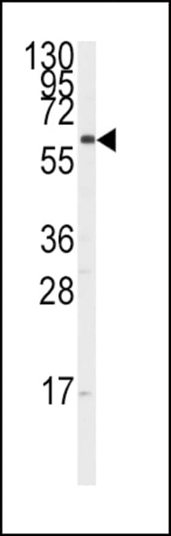 Invitrogen CYP17A1 Polyclonal Antibody 400 &mu;L; Unconjugated:Antibodies,