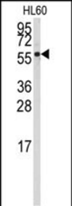 Invitrogen CYP4Z1 Polyclonal Antibody 400 &mu;L; Unconjugated:Antibodies,