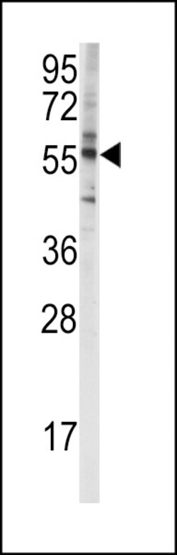 Invitrogen CYP4F8 Polyclonal Antibody 400 &mu;L; Unconjugated:Antibodies,