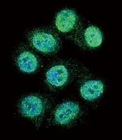 Invitrogen ALOX15 Polyclonal Antibody 200 μL; Unconjugated:Antibodies,