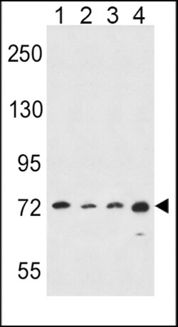 Invitrogen ALOX15 Polyclonal Antibody 200 μL; Unconjugated:Antibodies,