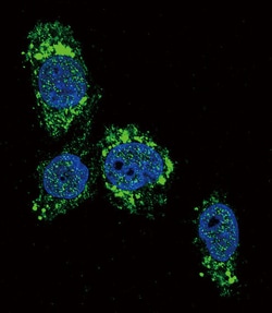 Invitrogen GCK Polyclonal Antibody 200 μL; Unconjugated:Antibodies,