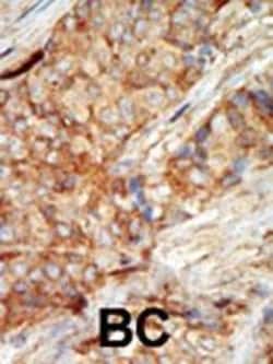 Invitrogen GCK Polyclonal Antibody 200 μL; Unconjugated:Antibodies,