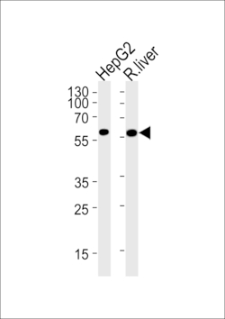 Invitrogen GCK Polyclonal Antibody 200 μL; Unconjugated:Antibodies,