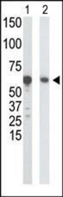 Invitrogen GCK Polyclonal Antibody 200 μL; Unconjugated:Antibodies,