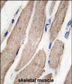 Invitrogen MEK5 Polyclonal Antibody 400 &mu;L; Unconjugated:Antibodies,