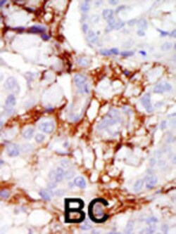 Invitrogen PAK3 Polyclonal Antibody 400 &mu;L; Unconjugated:Antibodies,